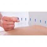 Dry Needles - Image 2